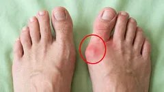 Verabschieden wir uns von den Knochen in den Füßen: 6 Übungen, mit denen wir gleichzeitig auch unsere Füße entspannen können